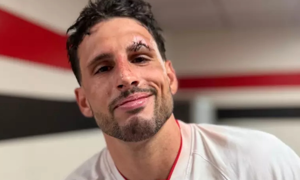 Calleri se machuca, sai de campo e São Paulo goleia Cruzeiro no Brasileirão