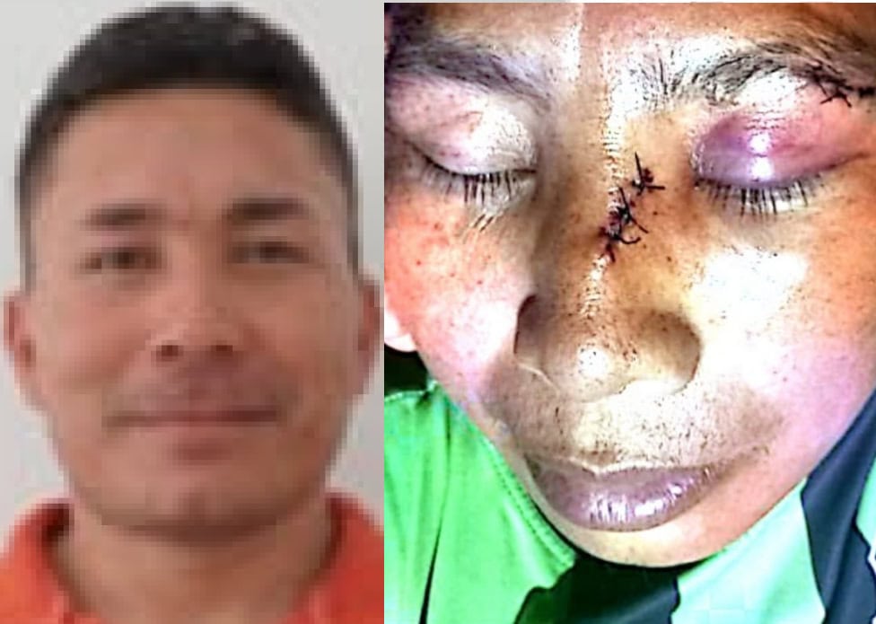 Vereador é acusado de agredir jogador após disputa acirrada em jogo no Acre