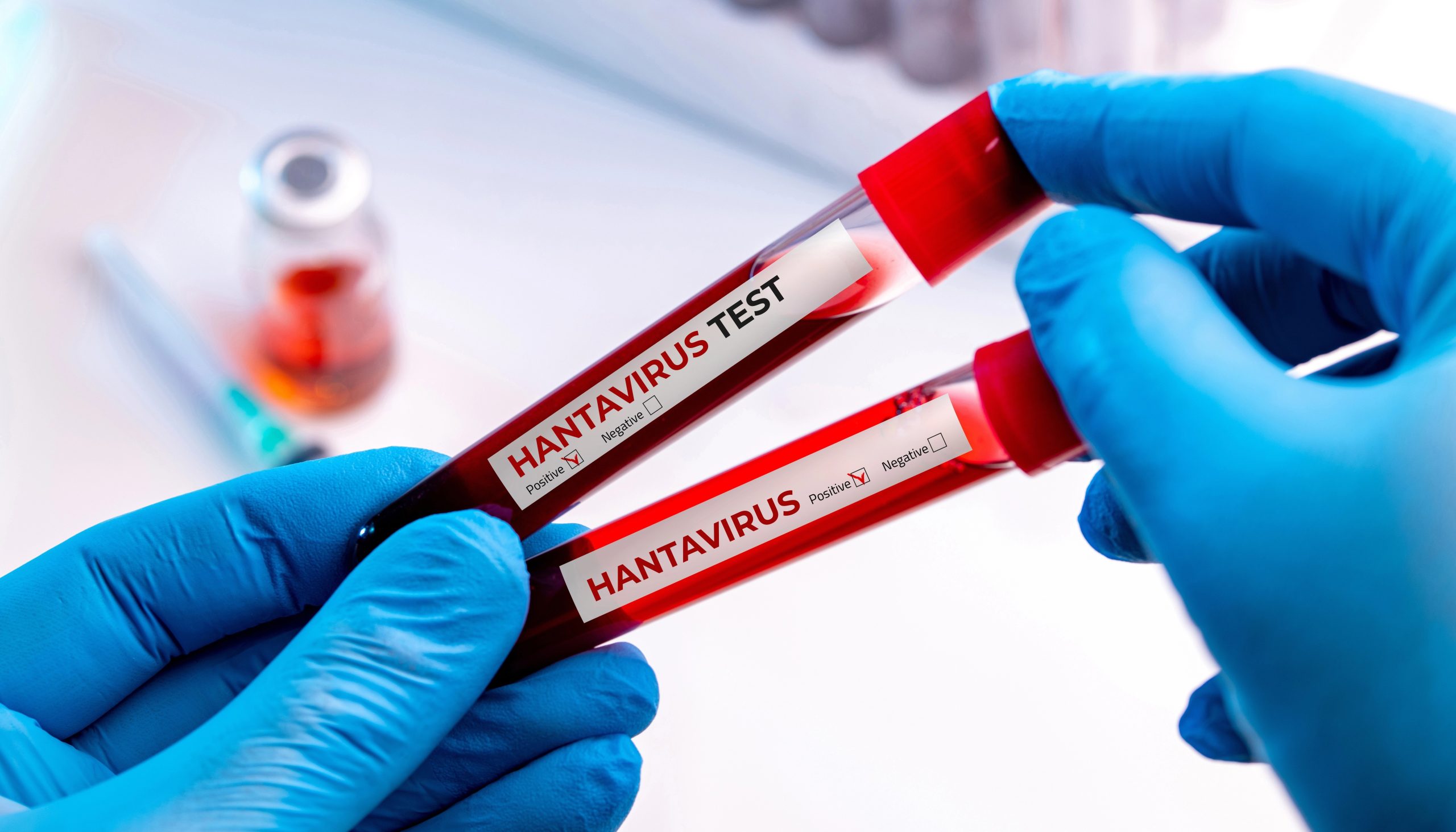Paraná confirma dois casos de hantavírus em 2026 e alerta para prevenção