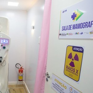 Carreta da Saúde da Mulher chega a Maceió para ampliar atendimento especializado